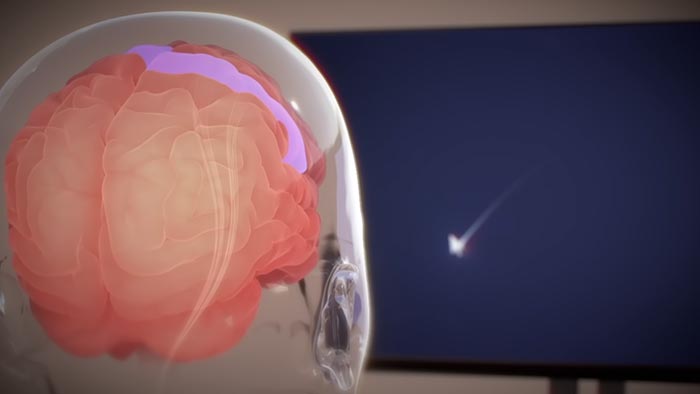 Neuralink ukazuje svůj mozkový čip umožňující člověku ovládat kurzor myši myšlenkami